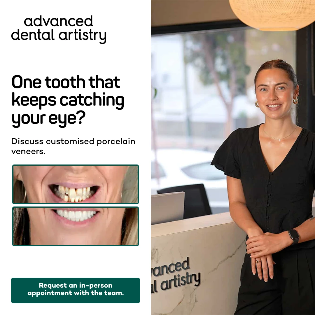 Porcelain veneer service ad creative